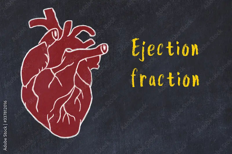 Ejection Fraction After Bypass Surgery